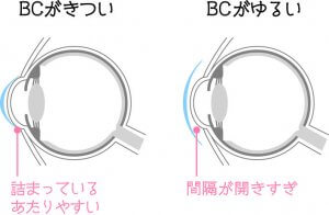 ベースカーブの図